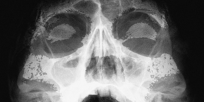 Converge Announce German Dates with Ministry & Grave Pleasures